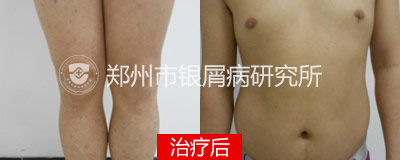 后.jpg