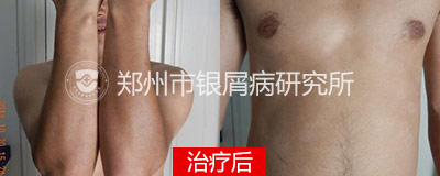 后.jpg
